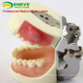 Oral Surgery Area Trainingsmodell Inzisionspus Removal Practice Model 12605